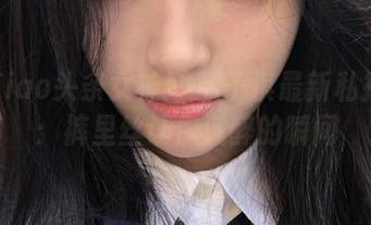 First Image