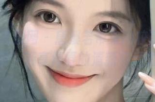 First Image