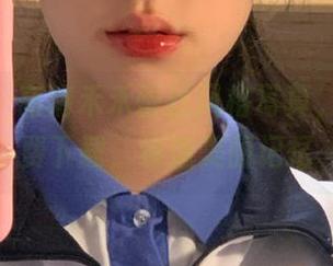 First Image