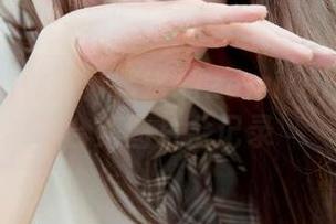 First Image